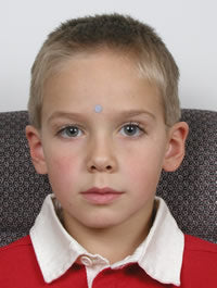target dot on young boy's forehead